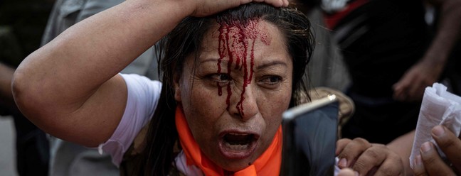 Manifestante é ferida durante protesto contra governo do presidente peruano Pedro Castillo, em Lima, em 20 de novembro de 2022.  — Foto: Ernesto BENAVIDES / AFP