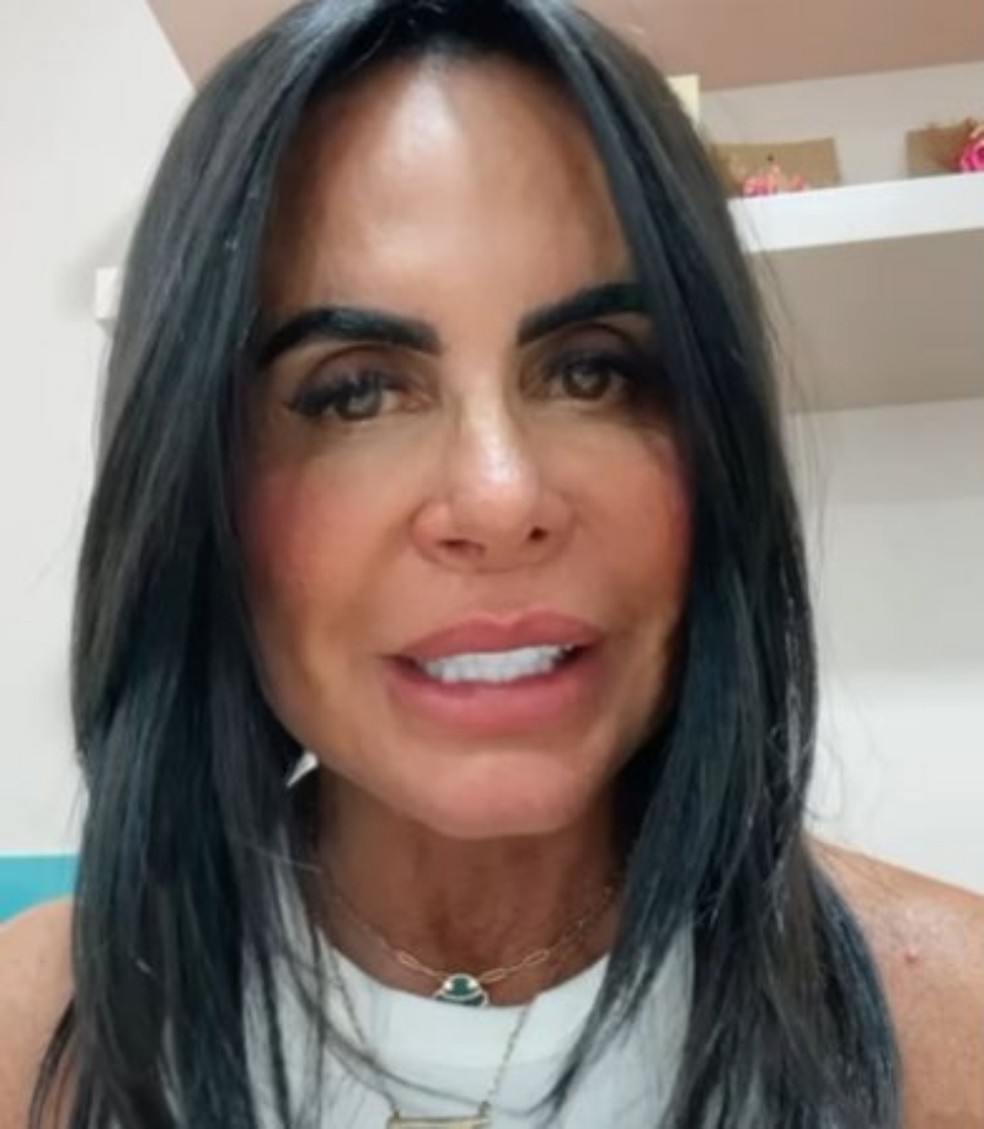 Gretchen mostrou novo rosto após procedimento — Foto: Reprodução Instagram