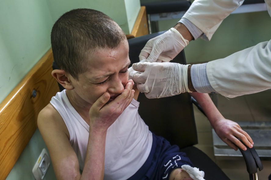 Mohamed Abu Rteinah, uma criança ferida por uma munição que atingiu sua casa em Rafah, chora de dor enquanto um médico cuida de suas queimaduras na Faixa de Gaza, em novembro de 2023