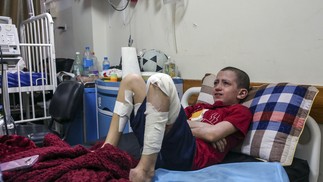 Mohamed Abu Rteinah, 12 anos, que foi queimado quando uma bomba atingiu sua casa no final de outubro de 2023, se recupera em Gaza em novembro. — Foto: Samar Abu Elouf/The New York Times