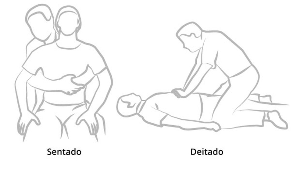Manobra Heimlich com a pessoa consciente em pé ou sentada. Sentado e deitado — Foto: Arte O Globo