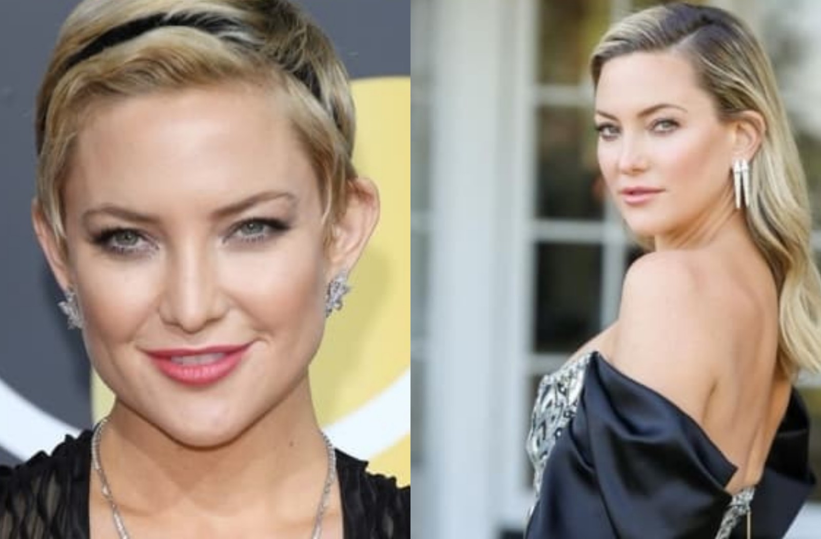 Otoplastia: antes e depois da atriz Kate Hudson