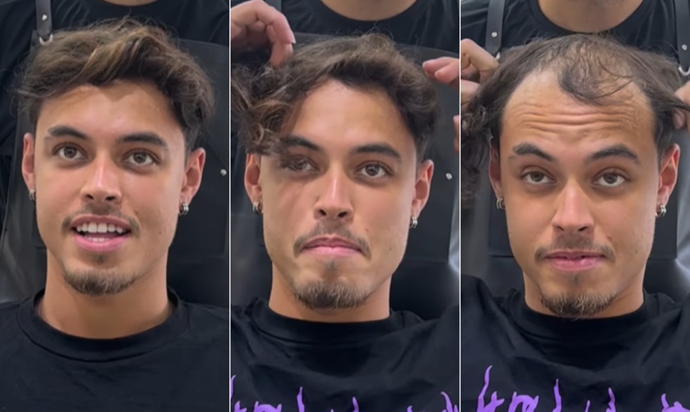 O influenciador digital Luiz Marães, de 25 anos, mostra como faz para esconder careca: fios presos com grampos — Foto: Reprodução/Instagram