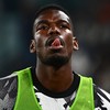 Pogba já foi o meio-campista mais caro do mundo - Isabella BONOTTO / AFP