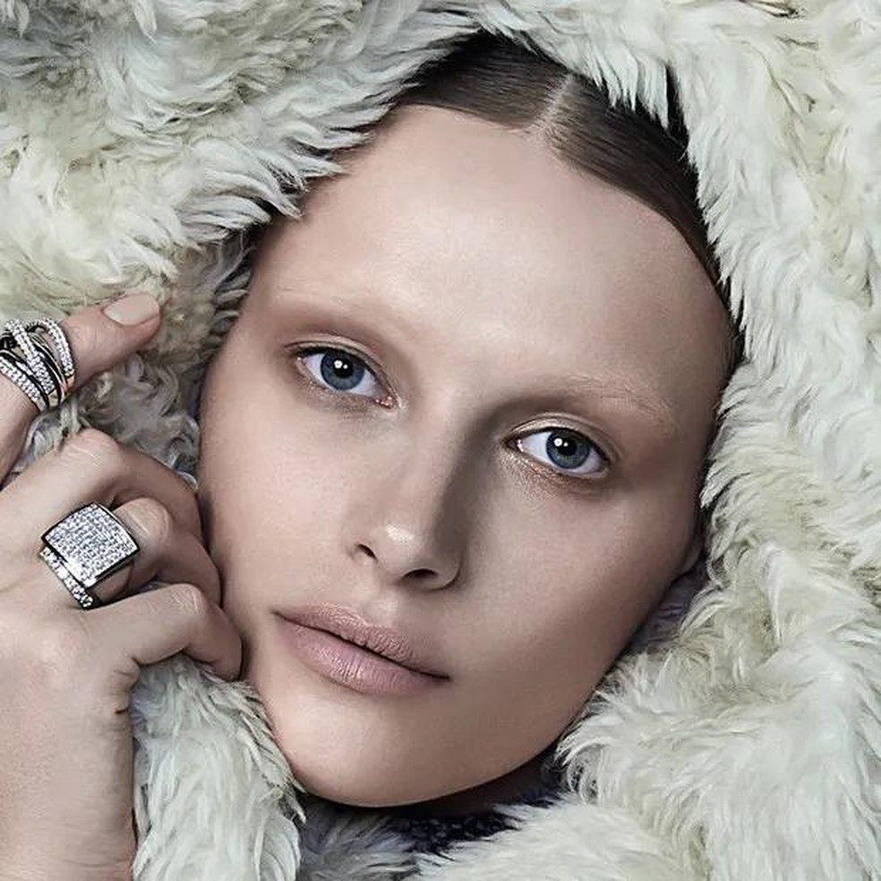 Pele no frio: 4 dicas para cuidar da acne no inverno (Foto: Reprodução) - Foto: Vogue — Foto: Vogue