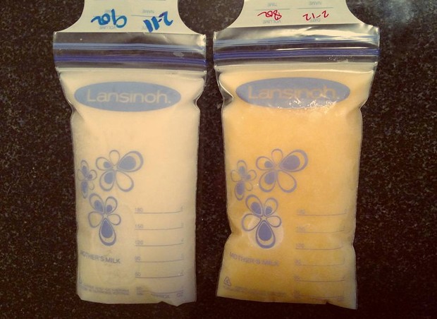 A foto postada por Mallory Smothers: à esquerda, o leite ordenhado antes do bebê ficar resfriado e, à direita, o leite ordenhado depois (Foto: Reprodução/ Facebook)