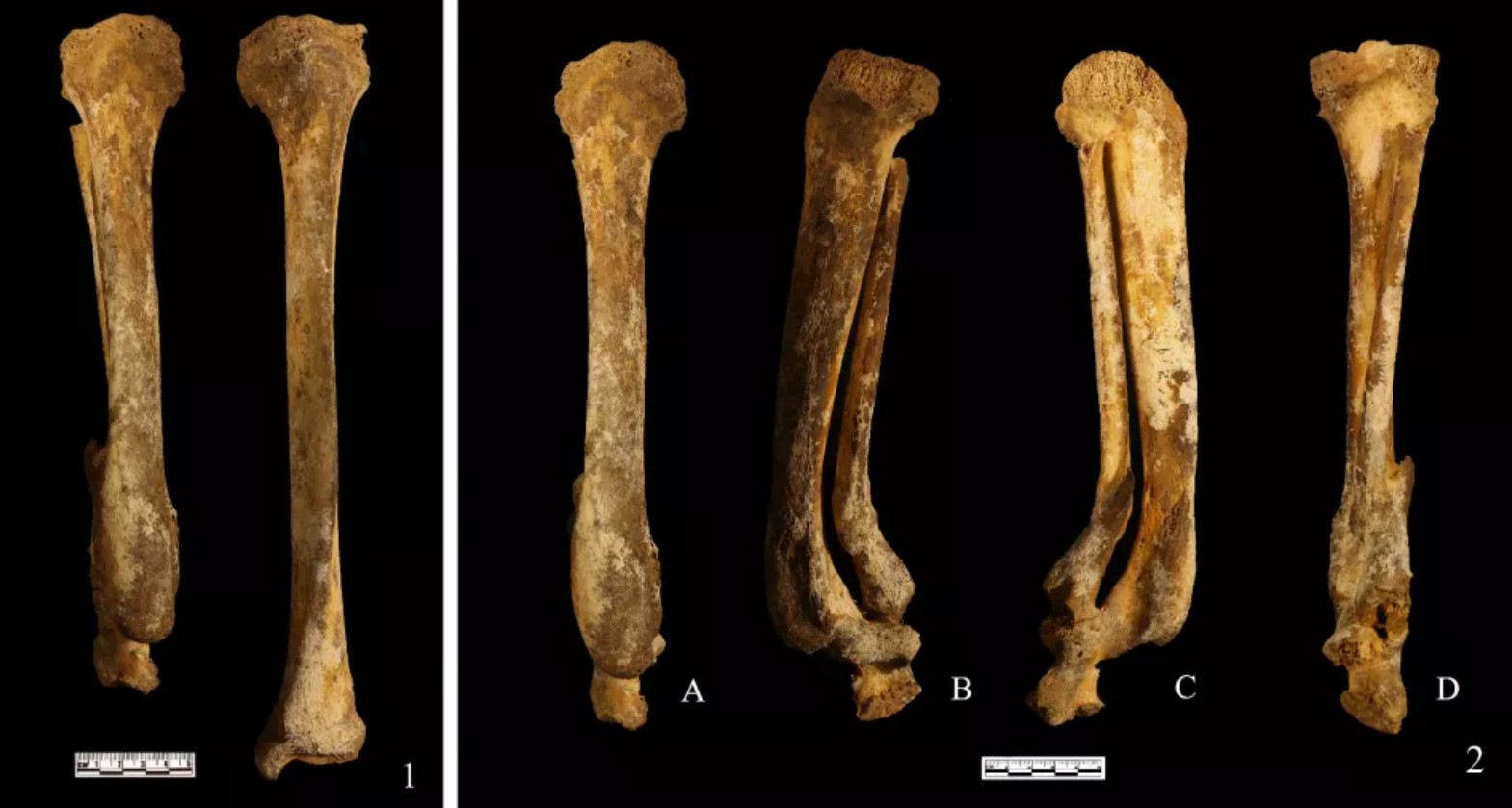 Arqueólogos encontram evidência de antiga punição chinesa em esqueleto  (Foto: Divulgação/ Li Nan)