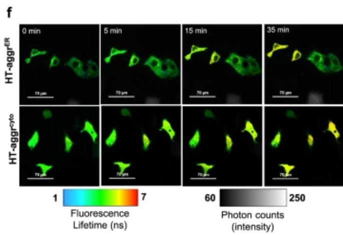 Cientistas identificaram um novo mecanismo para reverter o acúmulo de proteínas relacionadas à demência  (Foto: Eduardo Pinho Melo et.al )