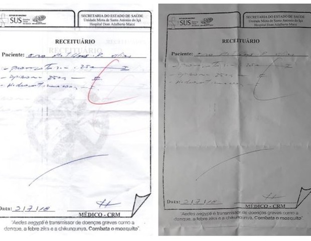 À esquerda, a receita prescrita inicialmente pelo médico. À direita, a cópia com a correção da dosagem para 2,5 mg (um ponto feito com caneta) (Foto: Reprodução G1/Arquivo Pessoal)