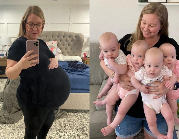 Antes e depois de mãe de quadrigêmeos (Foto: Reprodução TOday Parents )