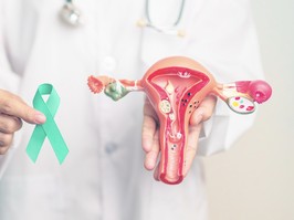 Doctor holding Teal ribbon with Uterus and Ovaries model for January Cervical Cancer Awareness month. Cervix, Endometriosis, Hysterectomy, Uterine, Reproductive, Healthcare and World cancer day