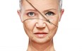 A dermatologist weighs in on how to minimize wrinkles.