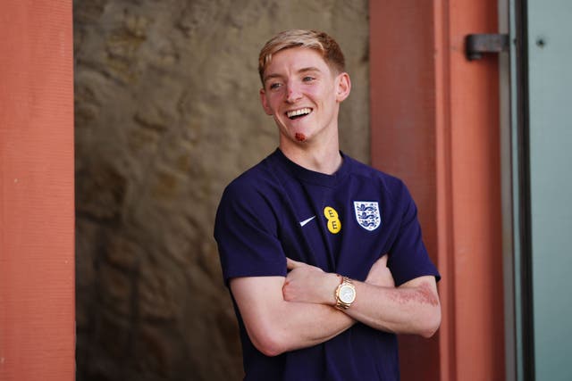 England’s Anthony Gordon poses after press conference at the England training base at Euro 2024. (Adam Davy/PA)