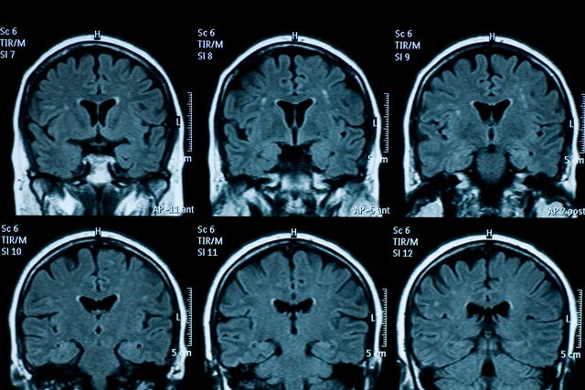 Mirror neurons in our brain fire when we view patterns – this can produce a sense of identification with letters