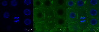 Green signal from anti-tubulin antibody conjugated with Alexa Fluor 488) and nuclei (blue signal from DNA stained with DAPI) in root meristem cells 4-day-old Arabidopsis thaliana (Col-0). Scale bar: 5 um.