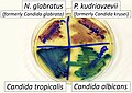 Chromogenic agar can help in indicating main species of Candida versus similar fungi. (CHROMAgar shown)