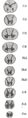 Cross-sections of the spinal cord at varying levels