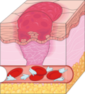 Thumbnail for File:Cardiovascular system - Healing 1 -- Smart-Servier.png