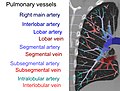 Computed tomography of a normal lung, with different levels of pulmonary veins.