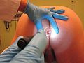The use of the anoscope for internal inspection of the lower rectum.