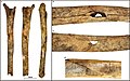 Burial 22. Perimortem butterfly fracture on the tibia