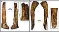 Burial 17 - Adult clavlicles with perimortem fractures that were deposited within the adult cranium.