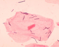 Бактерії Lactobacillus навколо вагінальних епітеліальних клітин