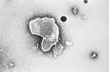 Electron micrograph of RSV