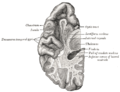 Section of brain showing upper surface of temporal lobe.