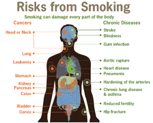 Risks form smoking-smoking can damage every part of the body.png