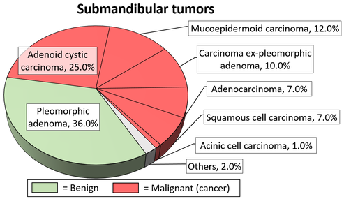 Relative incidence of submandibular tumors, showing carcinoma ex pleomorphic adenoma at bottom-right.[8]