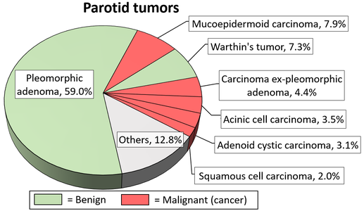 Relative incidence of parotid tumors, with adenoid cystic carcinoma being relatively rare.[17]