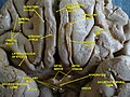 Cerebrum. Optic and olfactory nerves.Inferior view. Deep dissection.