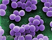 Scanning electron micrograph of S. aureus; false-color added