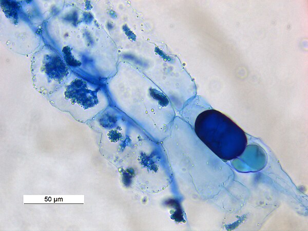 Arbuscles and hyphae in Vesicular Arbuscular Mycorhizae in root of Macrotyloma uniflorum. A vesicle is showing at right bottom