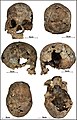 Burial 11 - Cranium