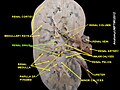 Renal sinus