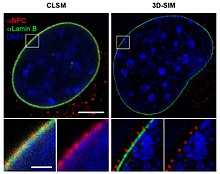 Порівняння роздільної здатності, отриманої за допомогою конфокальної лазерної скануючої мікроскопії (ліворуч) і 3D-мікроскопії зі структурованим освітленням (3D-SIM-мікроскопія, праворуч). Верхні зображення показують ядро ​​клітини миші, білі прямокутники збільшені внизу. Ядерні пори (анти-NPC, червоний) ядерна оболонка (анти-Ламін, зелений). Хроматин/ДНК (DAPI, синій). масштабні шкали: зверху 5 мкм, знизу 1 мкм.