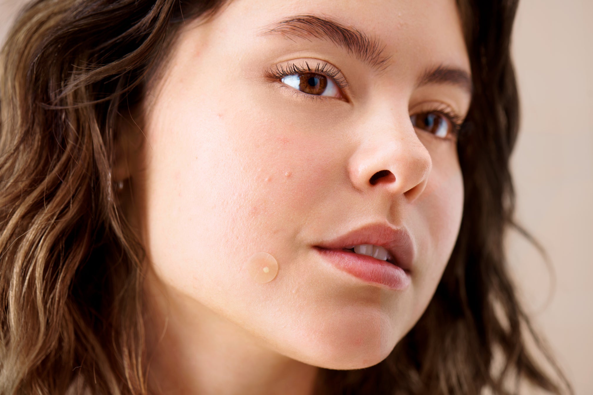 anna mei examining the types of acne she has in the mirror 