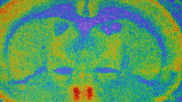 Visualization of a mouse brain