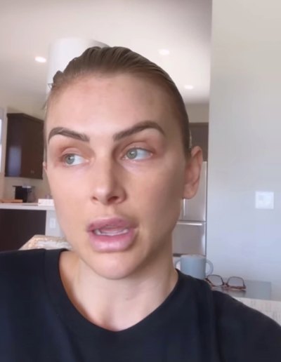 lala kent lips