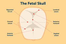 A diagram of the fontanelles of a baby's head.