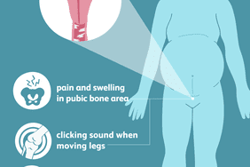 illustration of body highlighting pain and swelling in pubic area