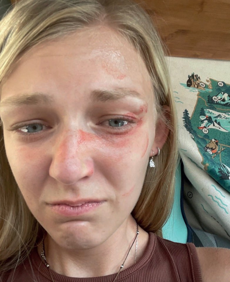 Lawyers for Gabby Petito's family have slammed police for 'ignoring' the danger she was in after a selfie of her injured face was revealed