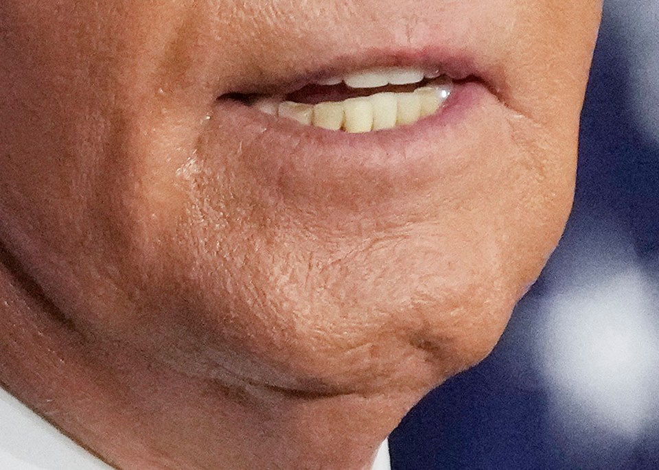 Biden's chin has caught a lot of attention from viewers