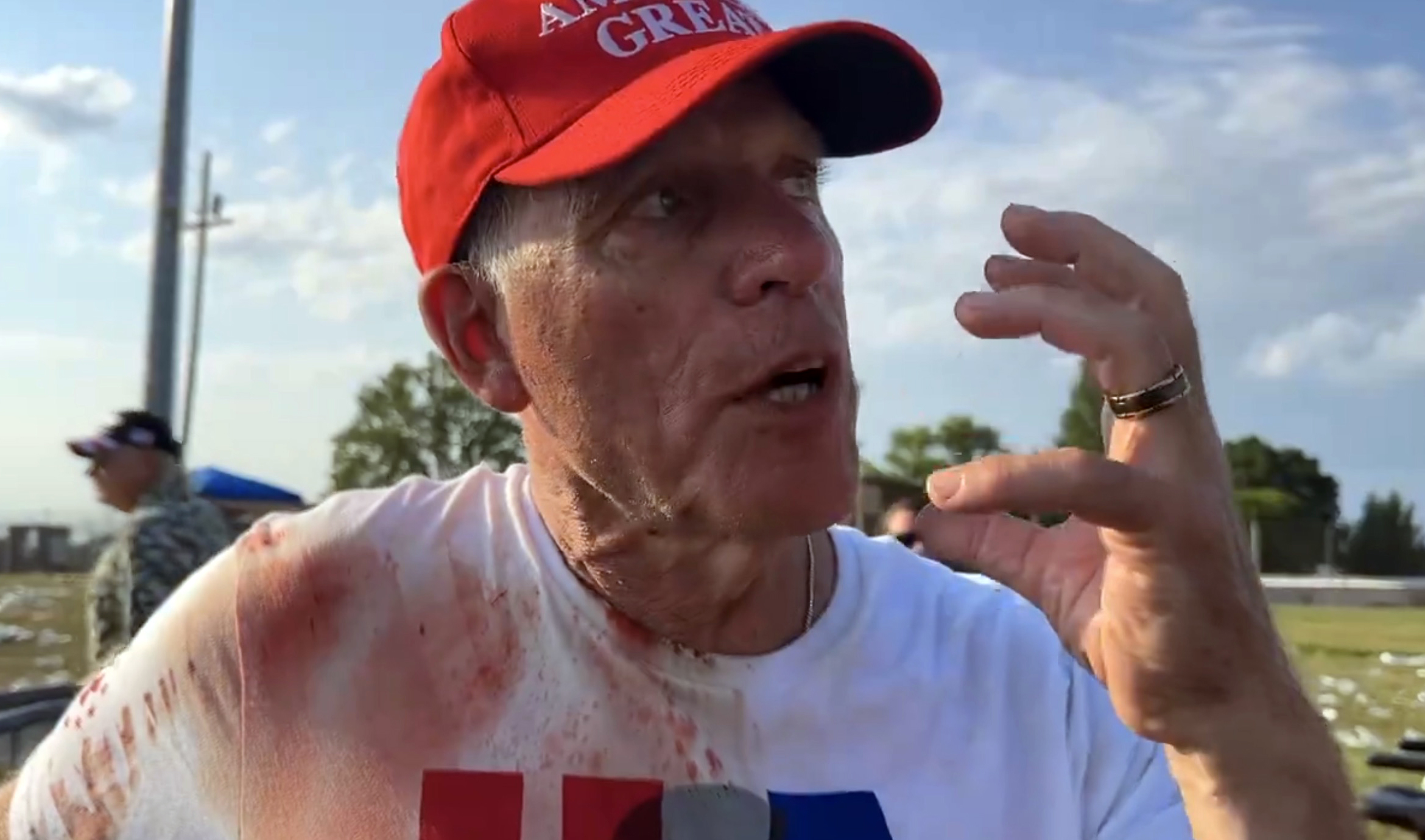 A bloodied doctor tells media about his attempts to help someone in the crowd