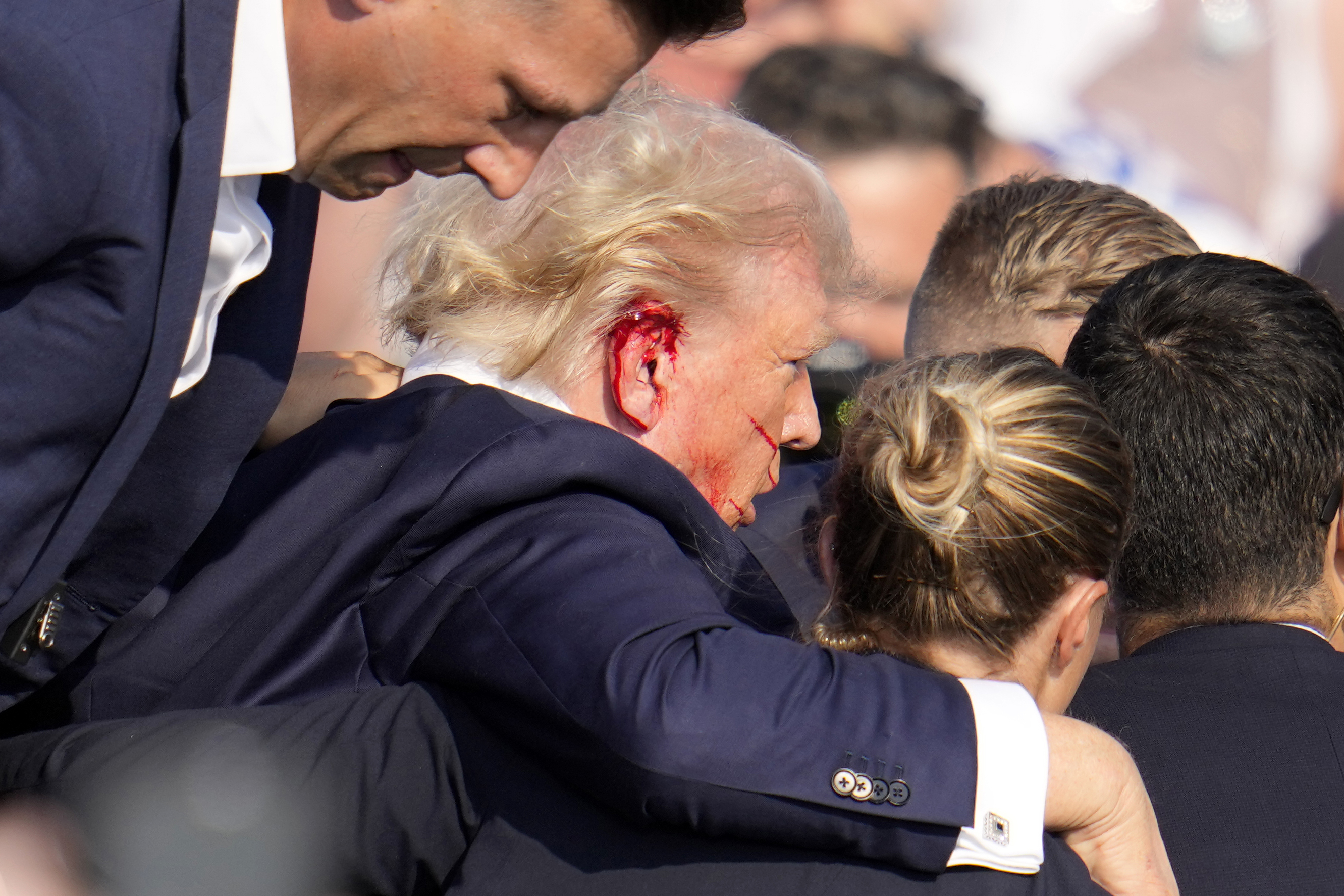 Trump was seen bleeding from his right ear as Secret Service agents whisked him away