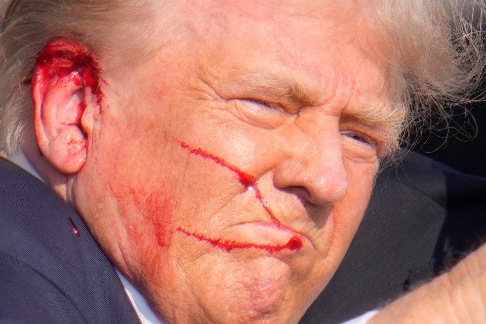 Trump sustained minor injuries to his right ear before being swarmed by Secret Service