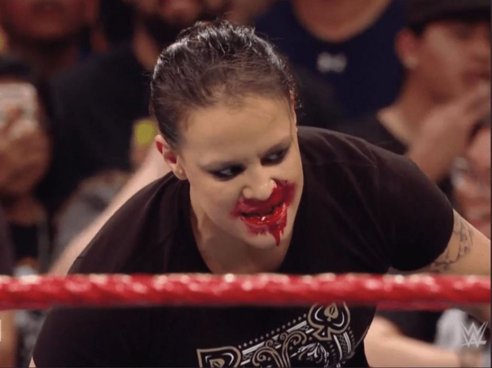  Shayna Baszler shockingly bit Becky Lynch to leave her a bloody mess on RAW