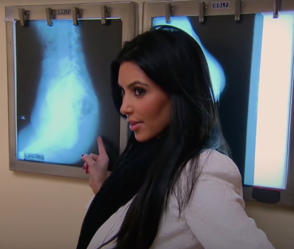 Kim had an X-ray of her bottom done nine years ago to prove it was real